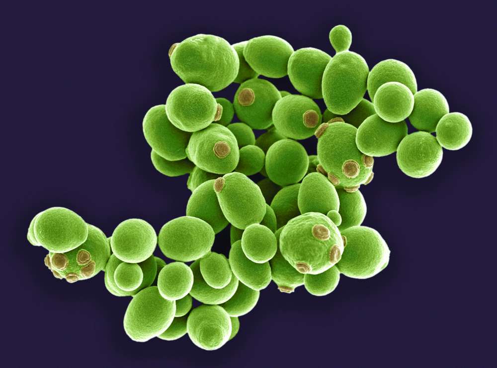 Yeast cells